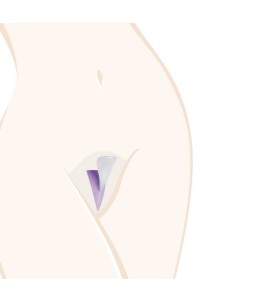 Pochoir Rasage Intime LADYSHAPE Triangle E23713